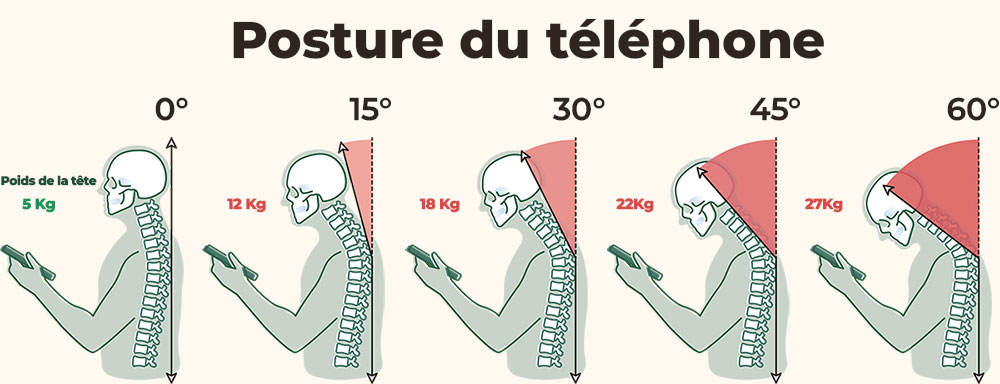 Schéma des impacts de la posture du téléphone sur la colonne vertébrale selon l’inclinaison de la tête